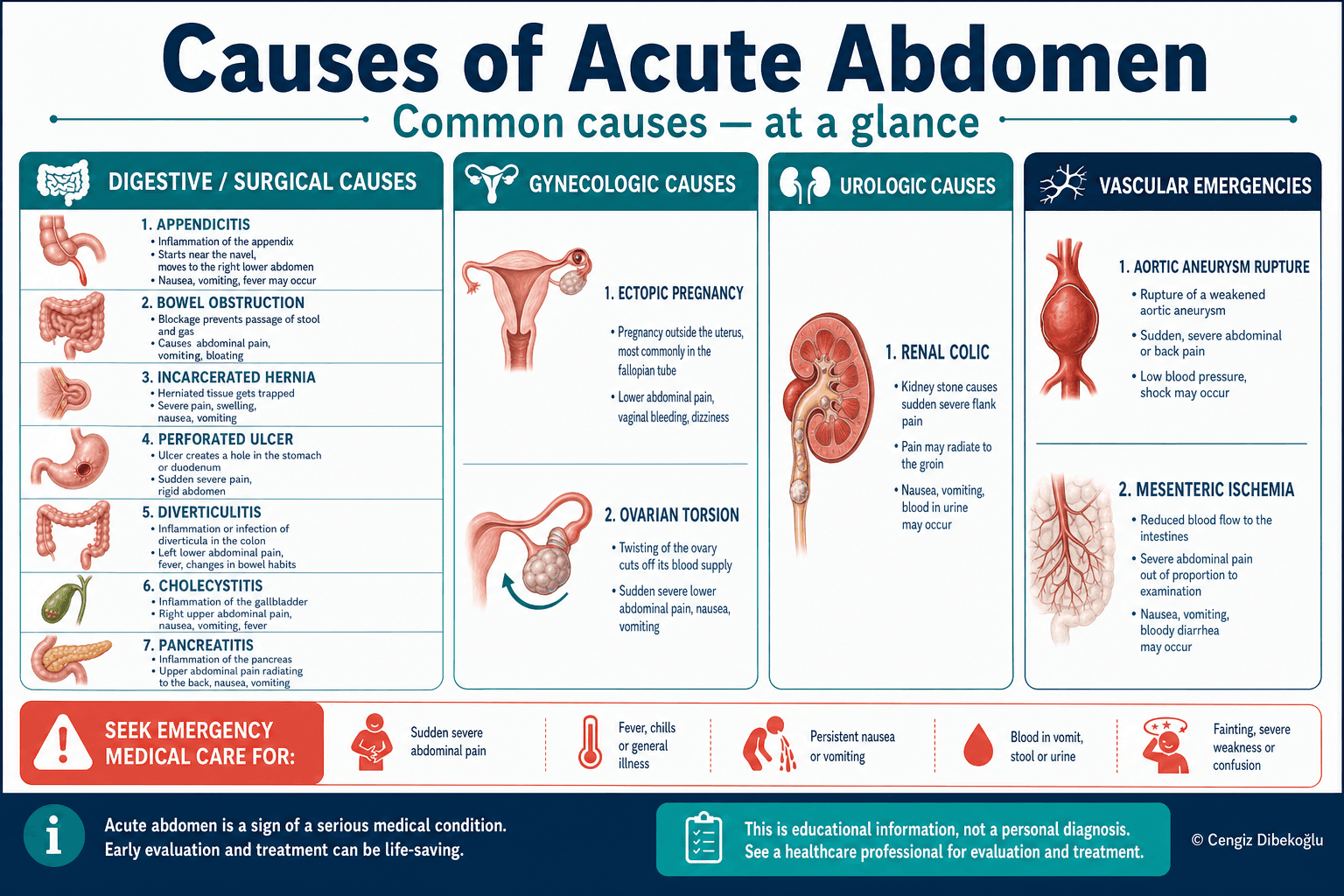 Causes of acute abdomen — educational figure