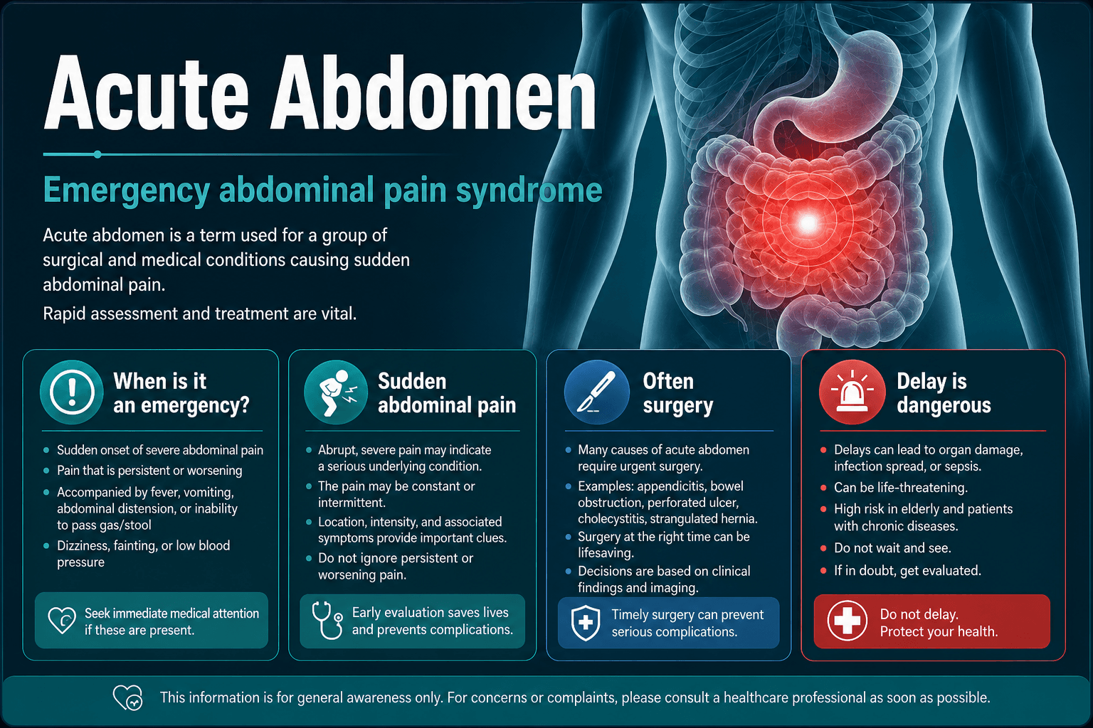 Acute Abdomen — educational figure
