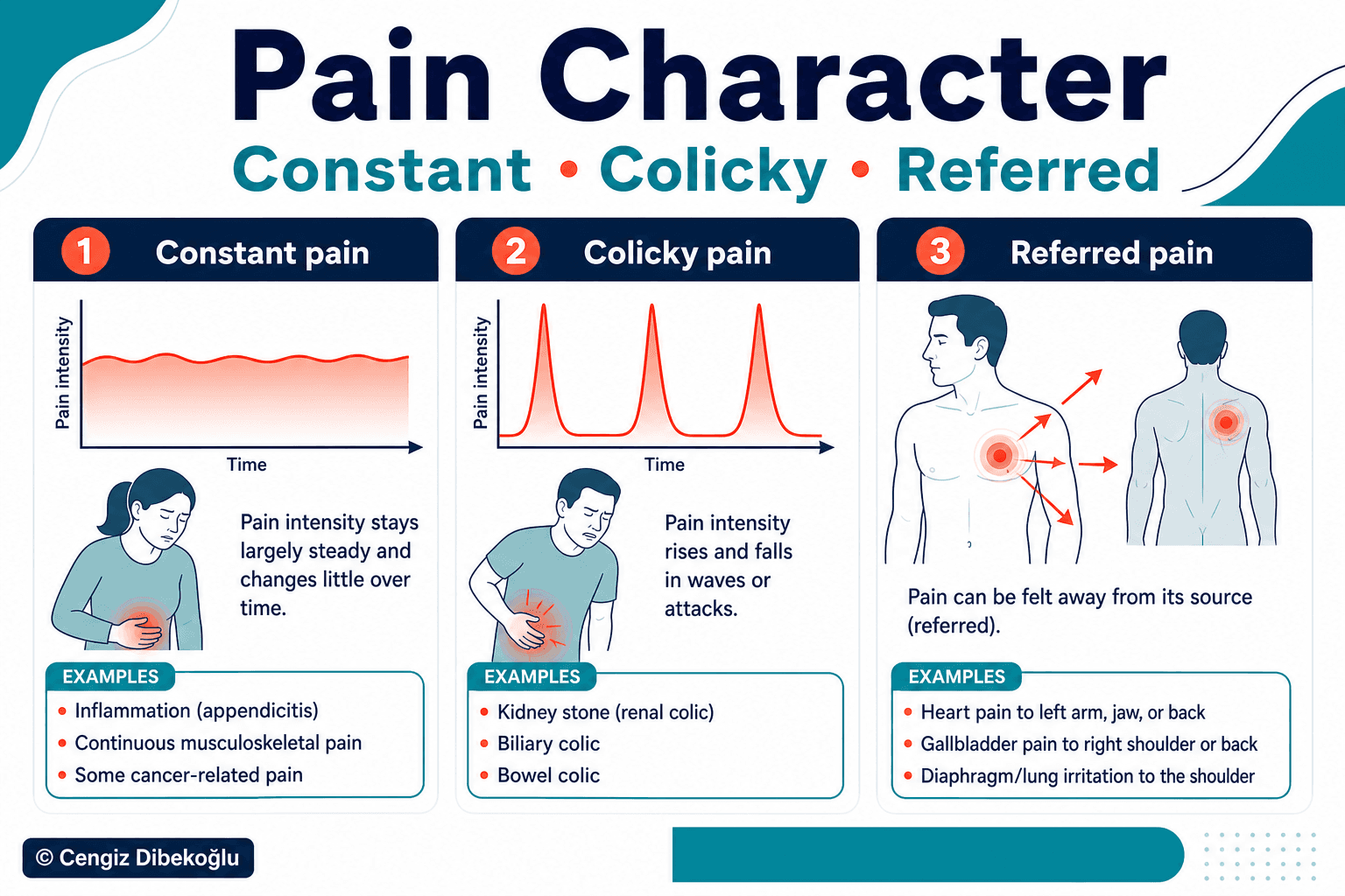 Acute abdomen pain character — educational figure