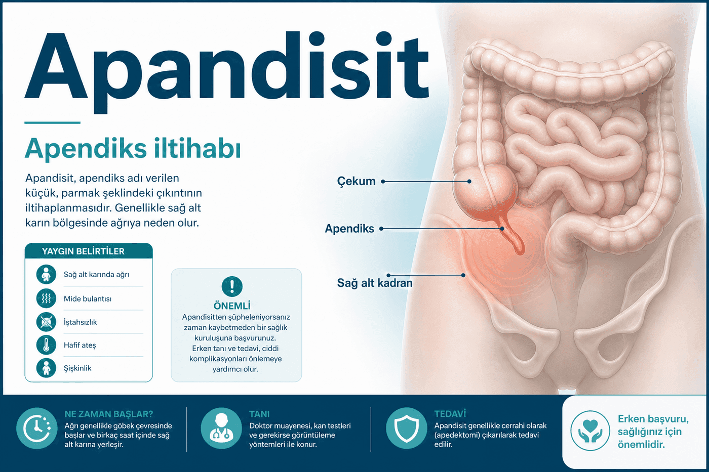 Apandisit görseli