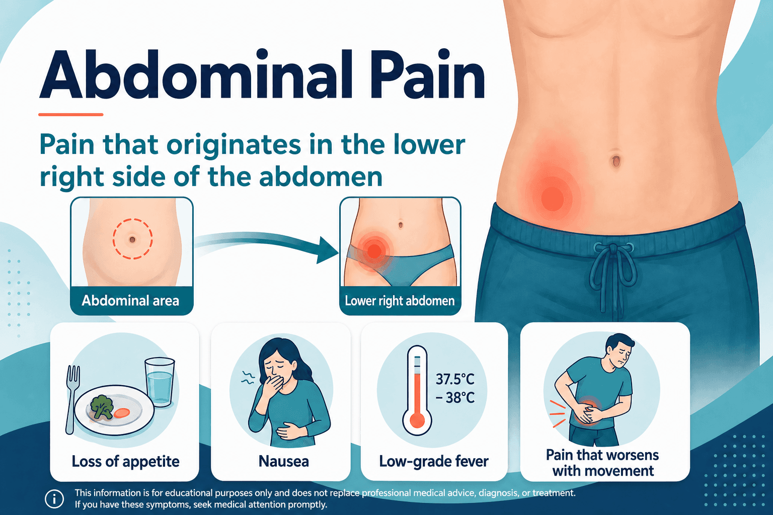 Appendicitis — educational figure