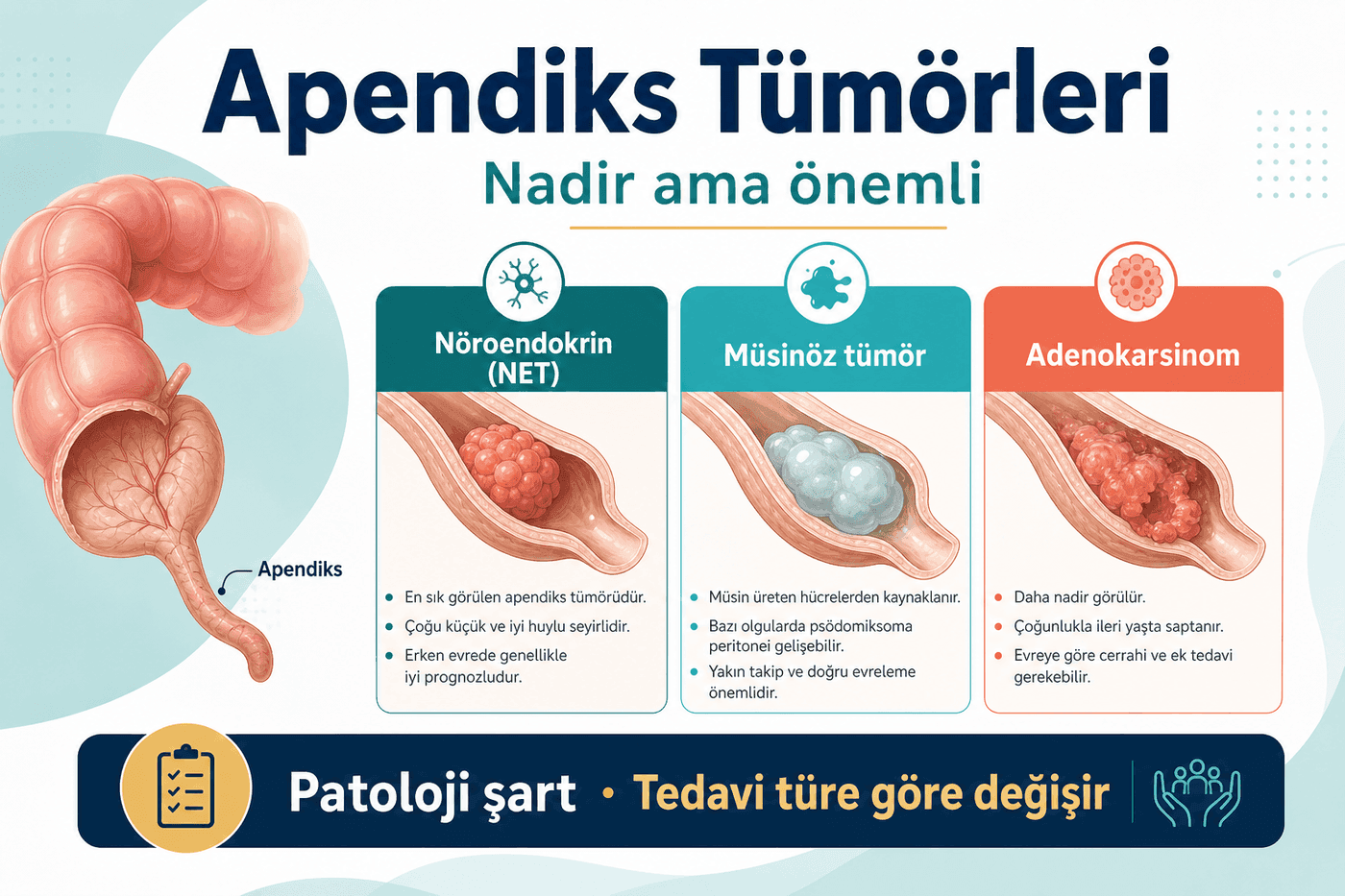 Apendiks tümörleri