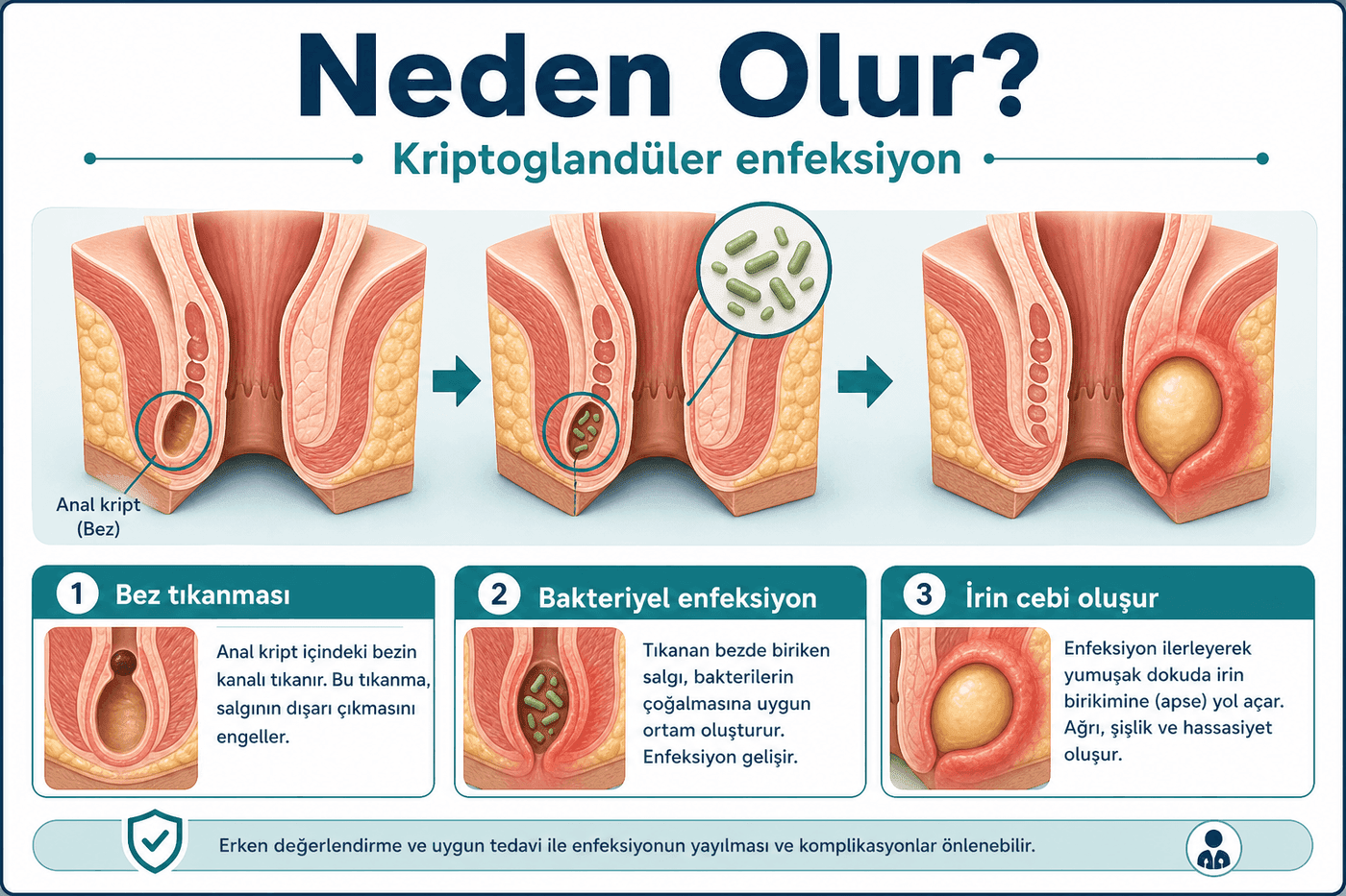 Neden olur?