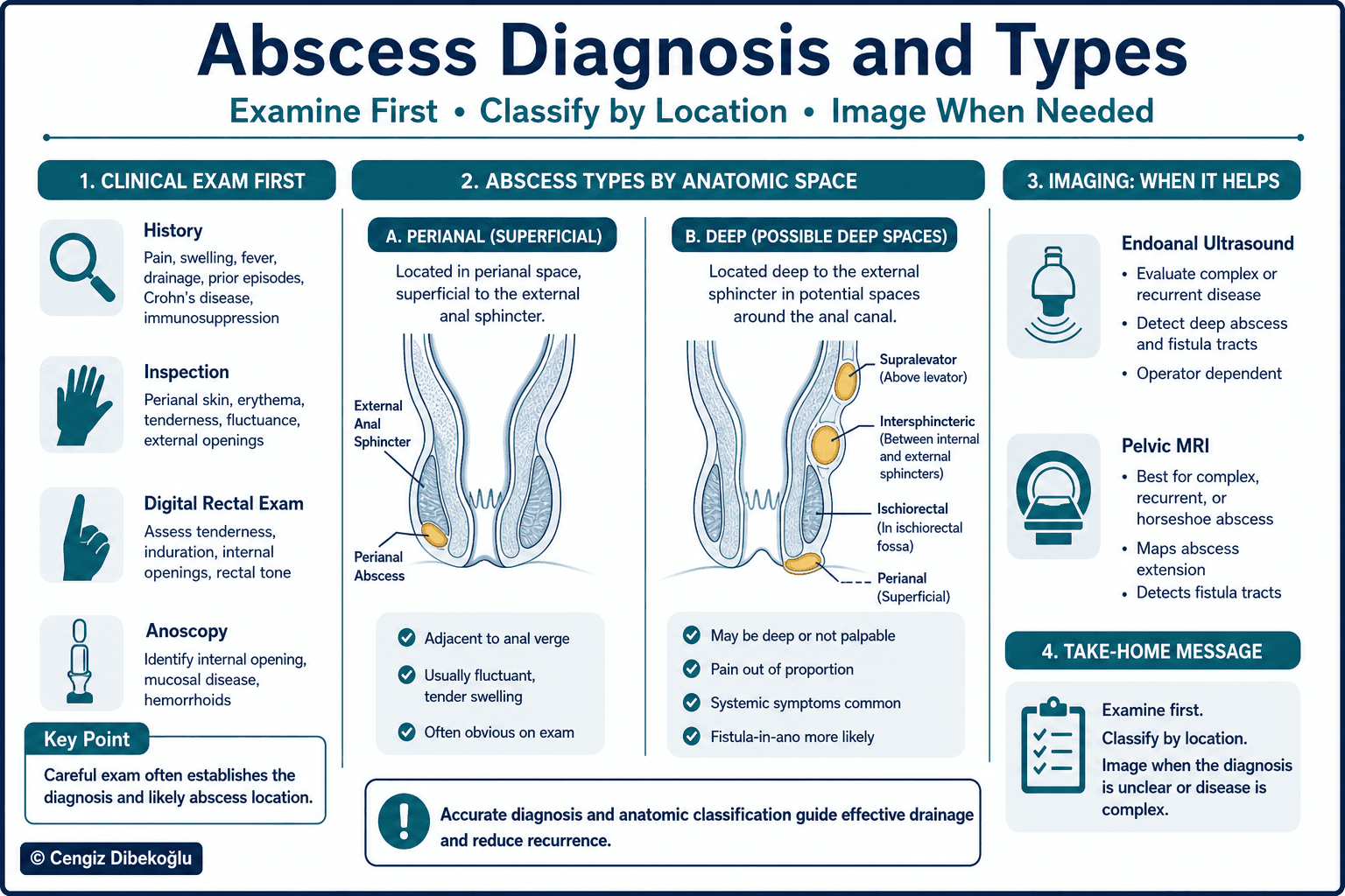 Anal abscess diagnosis and locations — educational figure