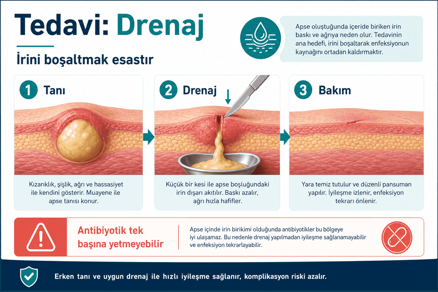 Tedavi / Drenaj