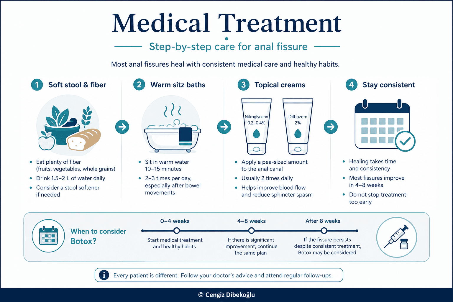 Anal fissure cream treatment — educational figure