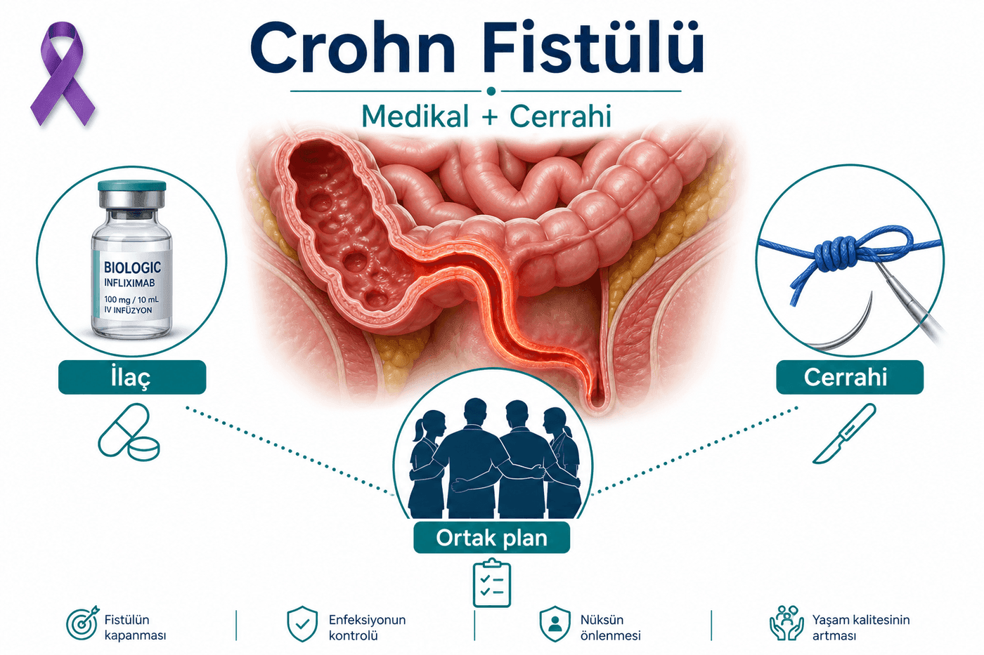 Crohn