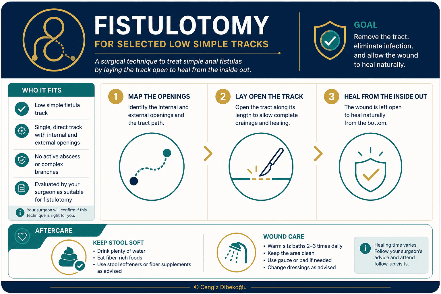 Fistulotomy — educational figure