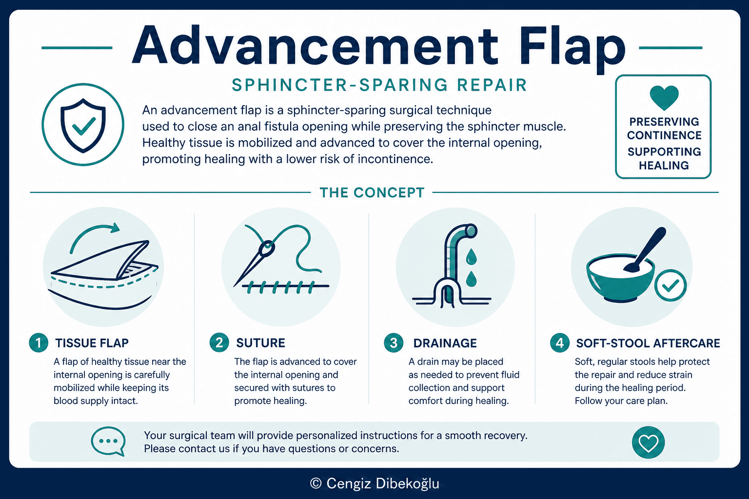 Advancement flap — educational figure