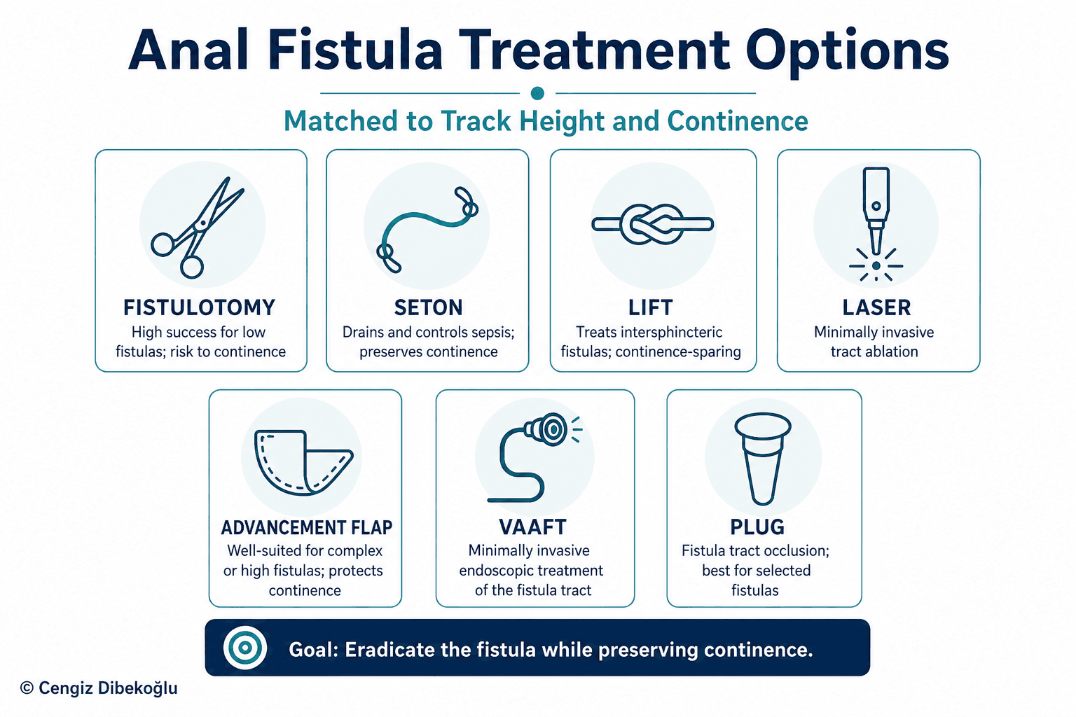 Anal fistula treatment options — educational figure