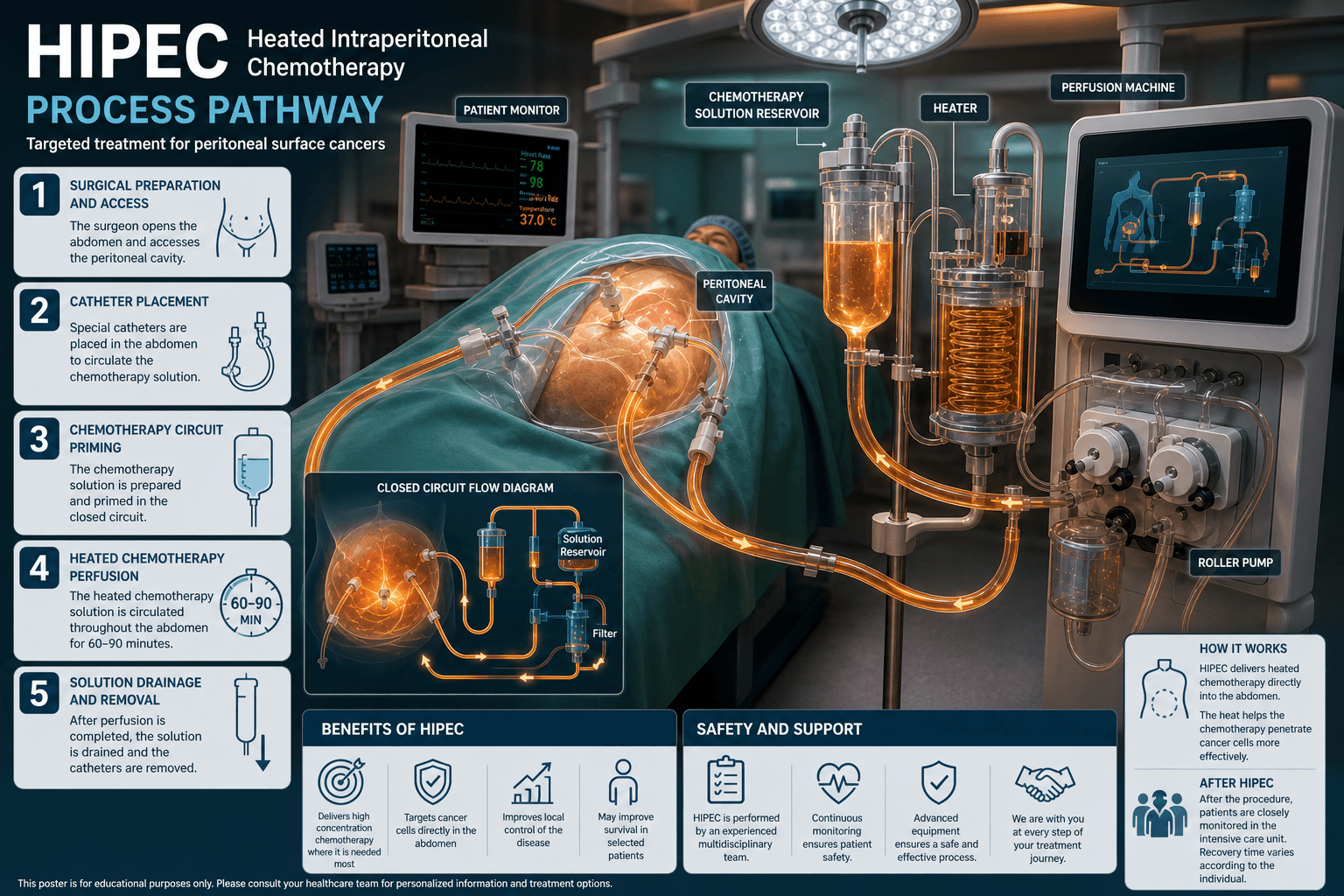 CRS/HIPEC process — educational figure