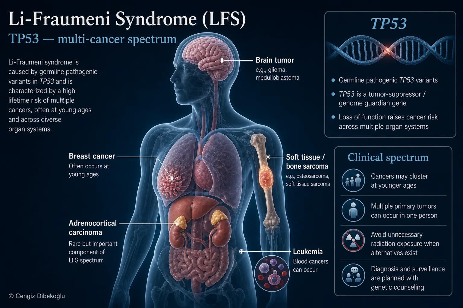 Li-Fraumeni syndrome — educational figure