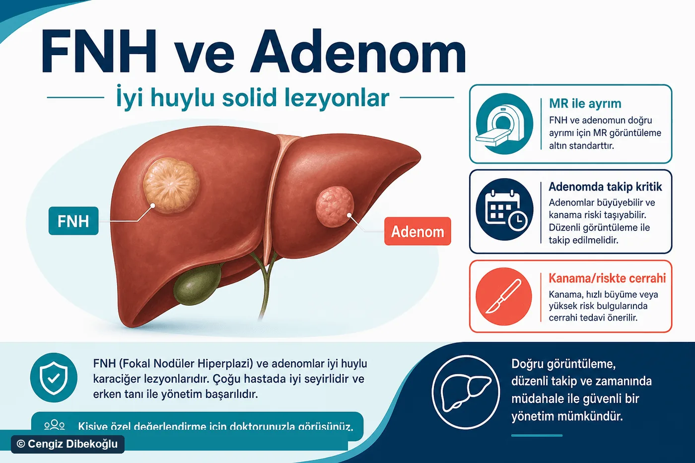 3D diagram: fnh and adenoma
