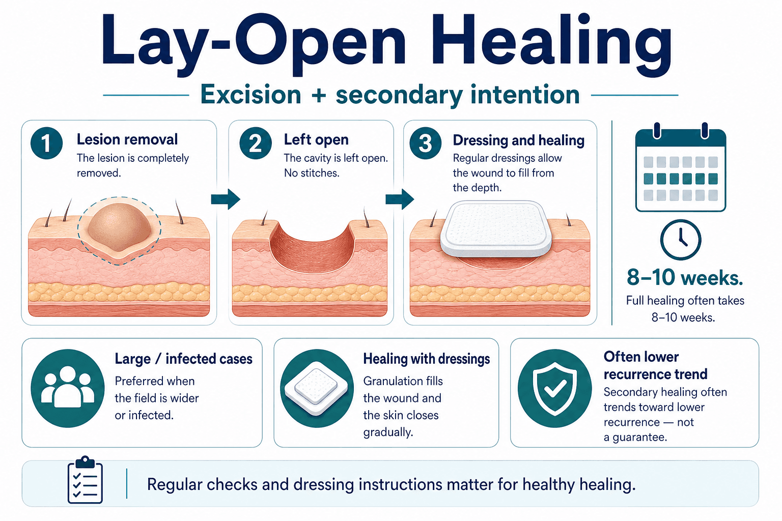 Lay-open for pilonidal disease — English educational figure