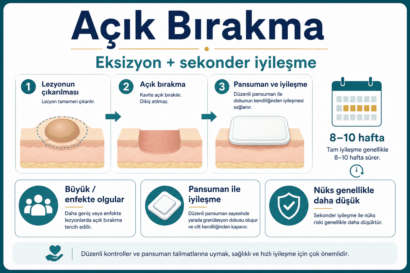 Açık bırakma