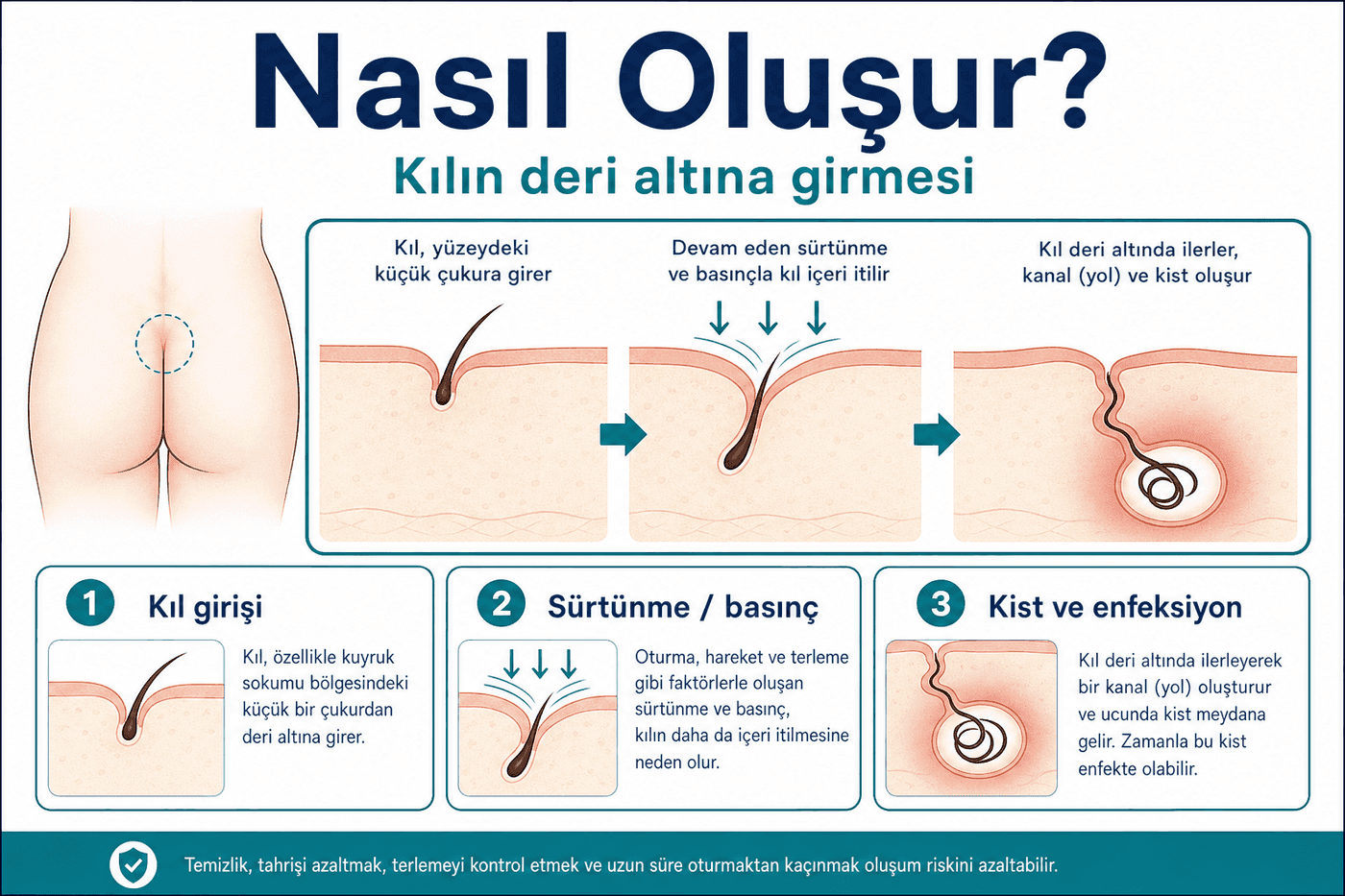 Nasıl oluşur?