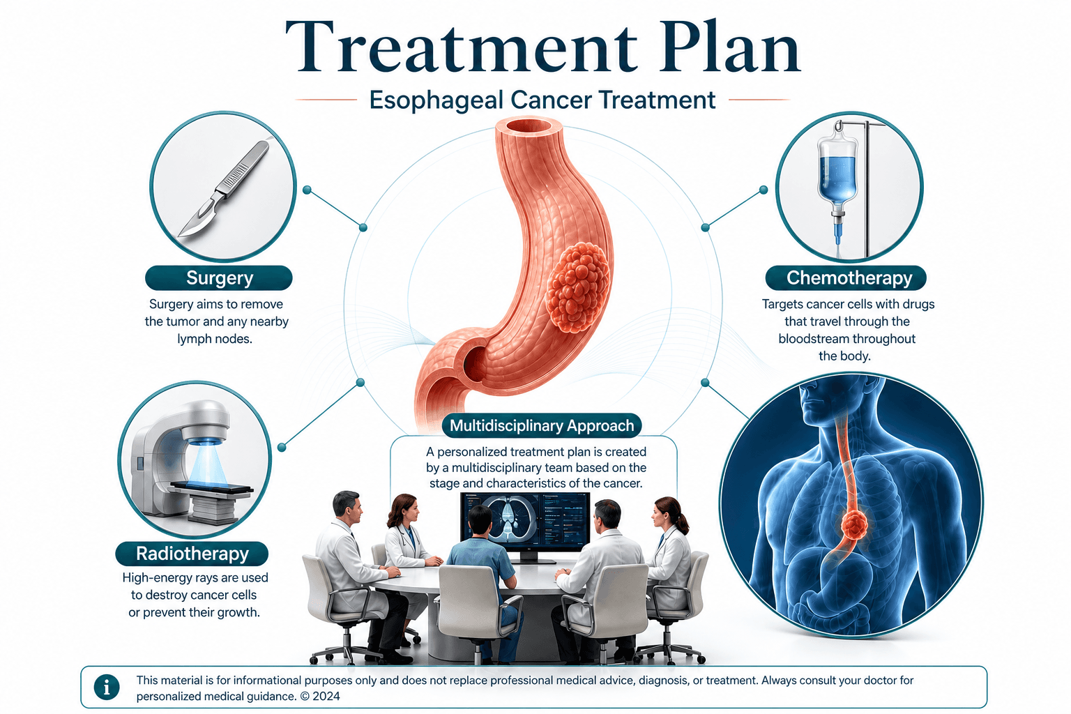 Esophageal cancer treatment — educational figure