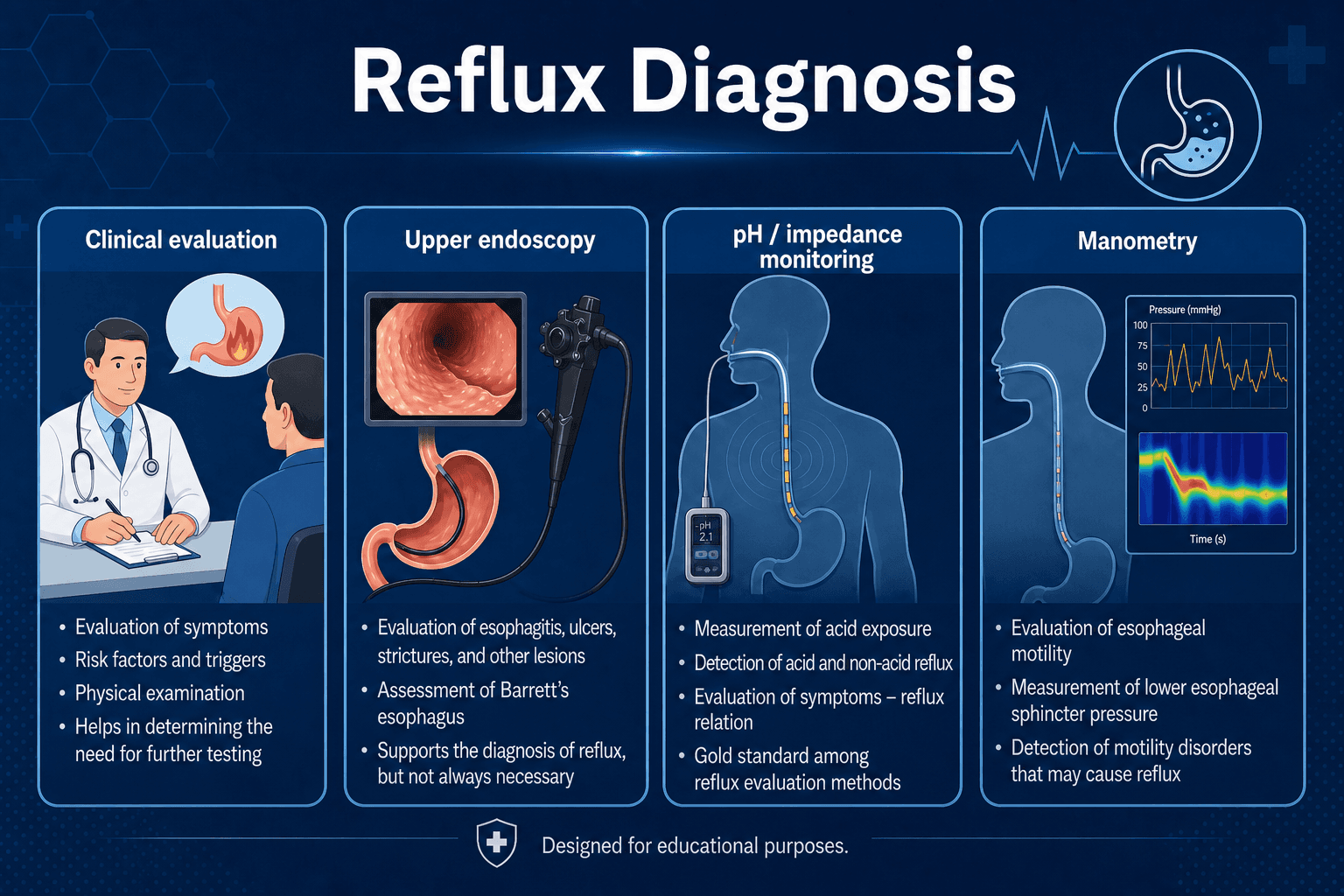 GERD diagnosis — educational figure