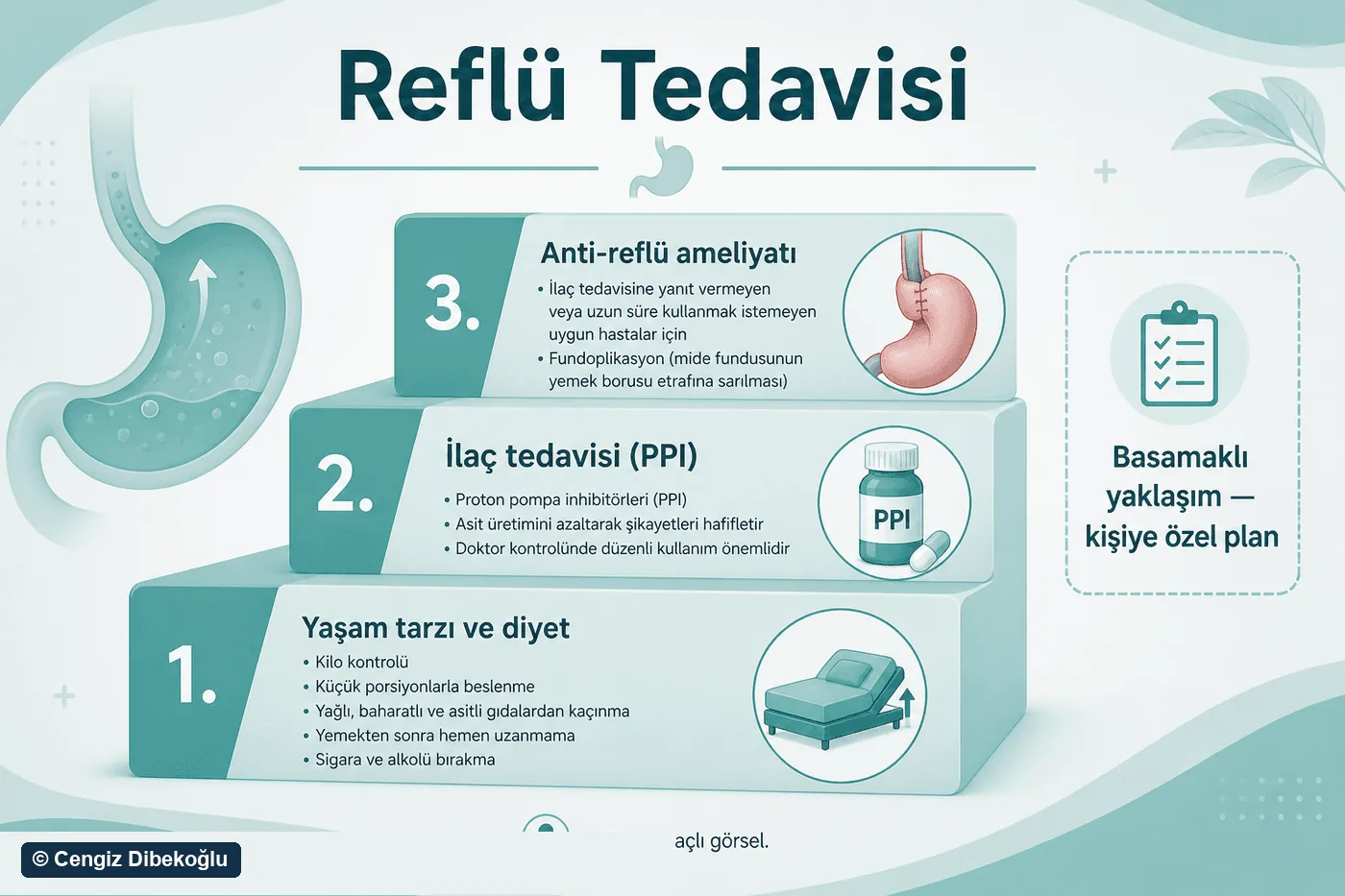 3D diagram: gerd treatment
