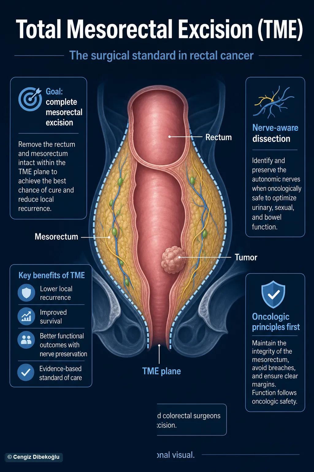 3D diagram: pelvic rectal field and TME