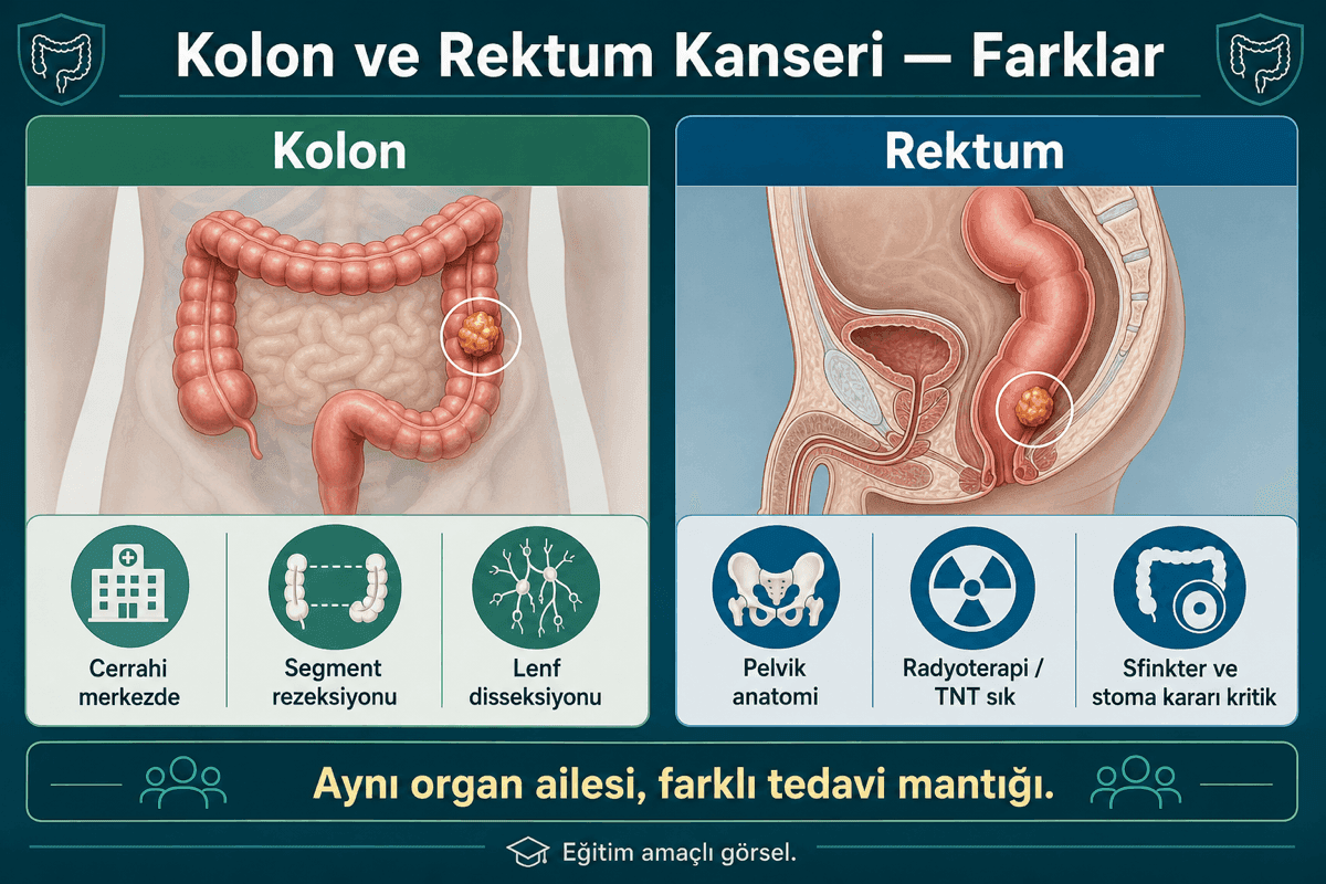 Kolondan farkları