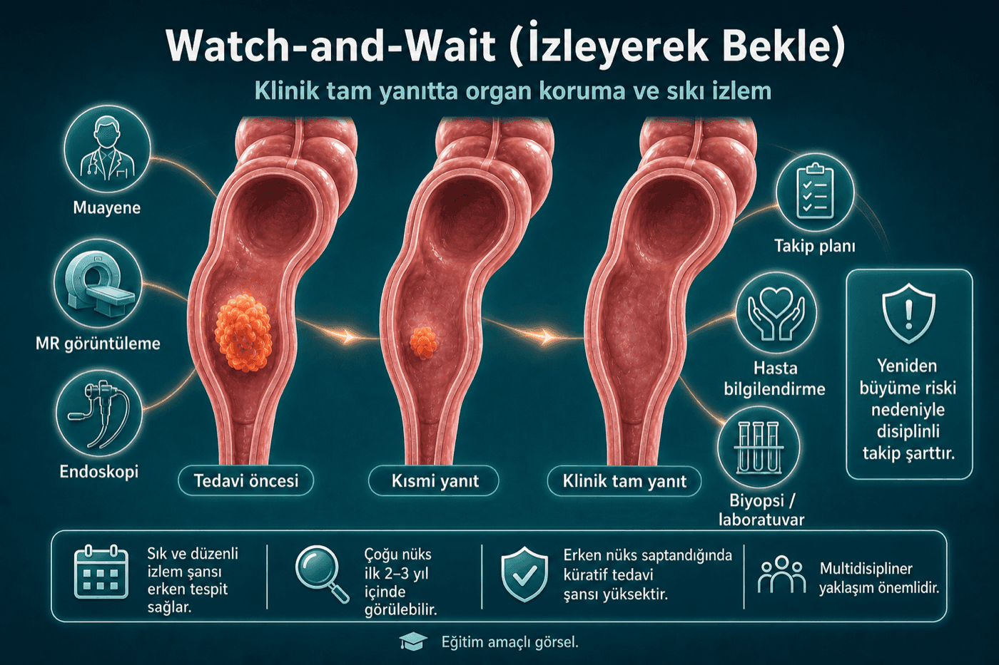 Watch-and-Wait (İzlem)