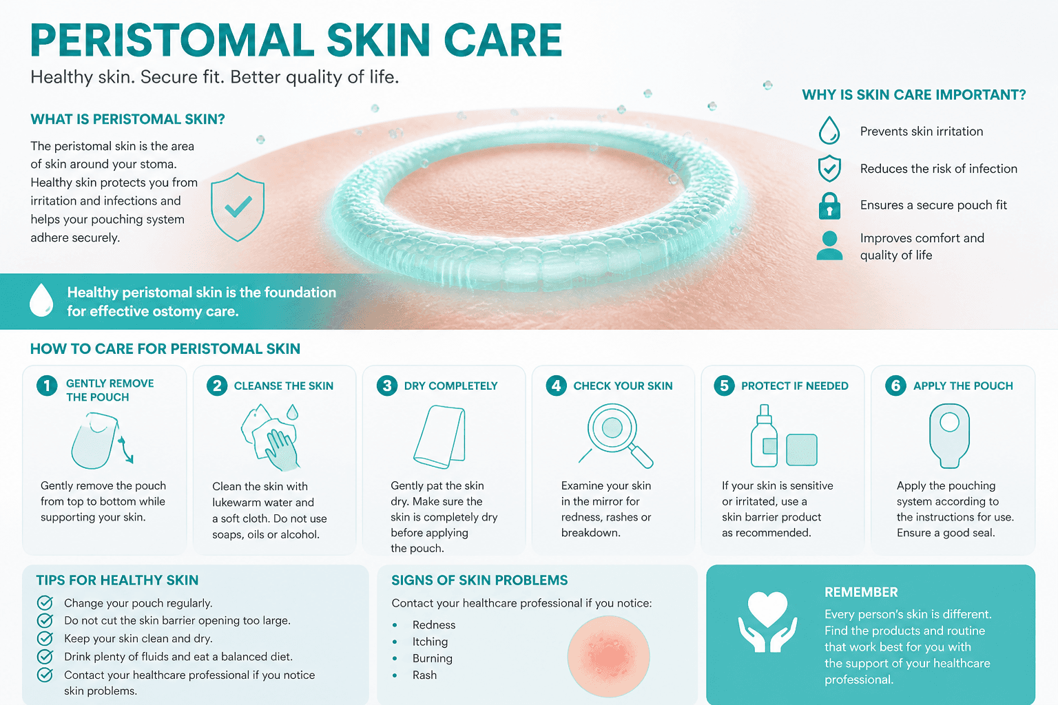 Peristomal skin care — educational figure