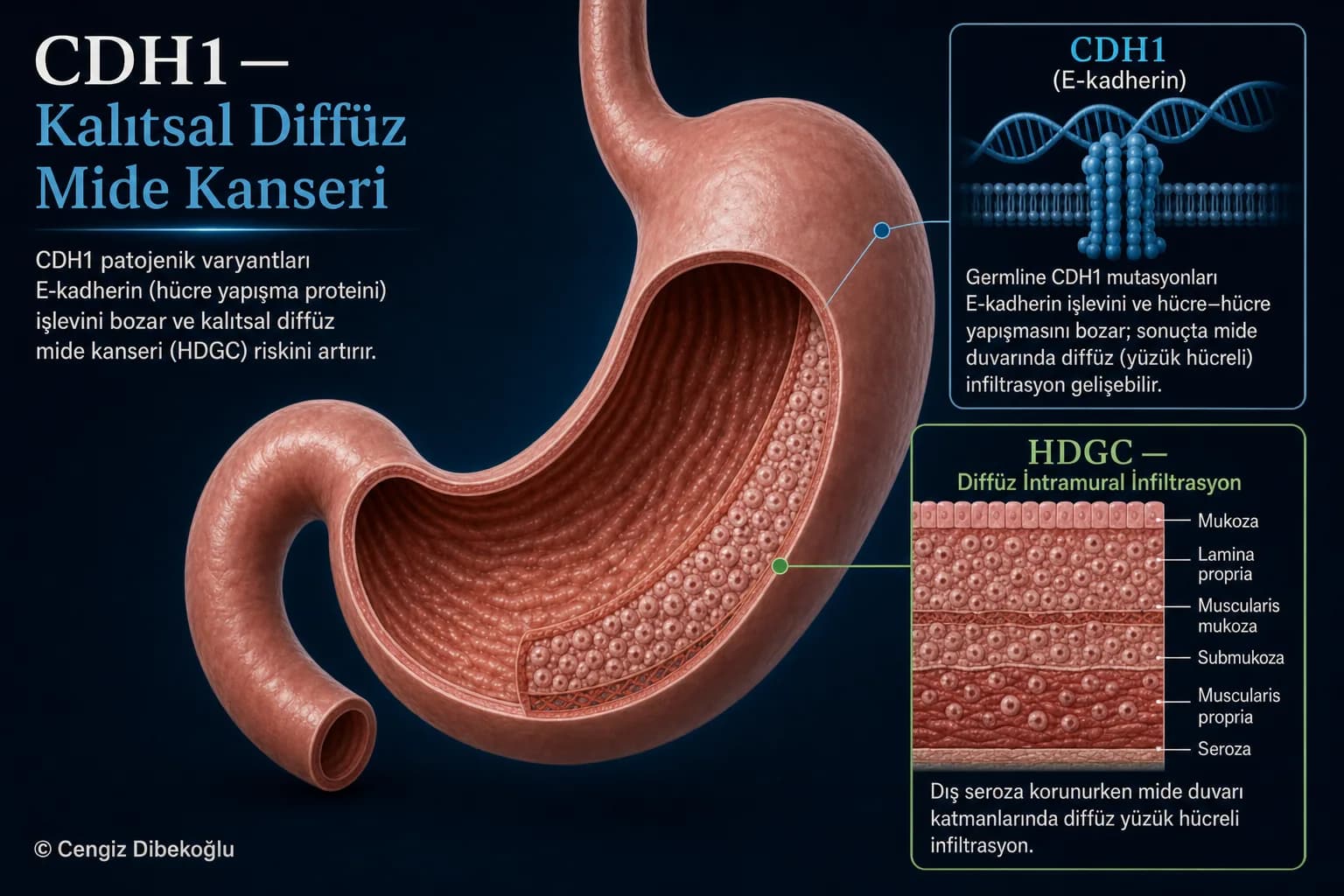 CDH1