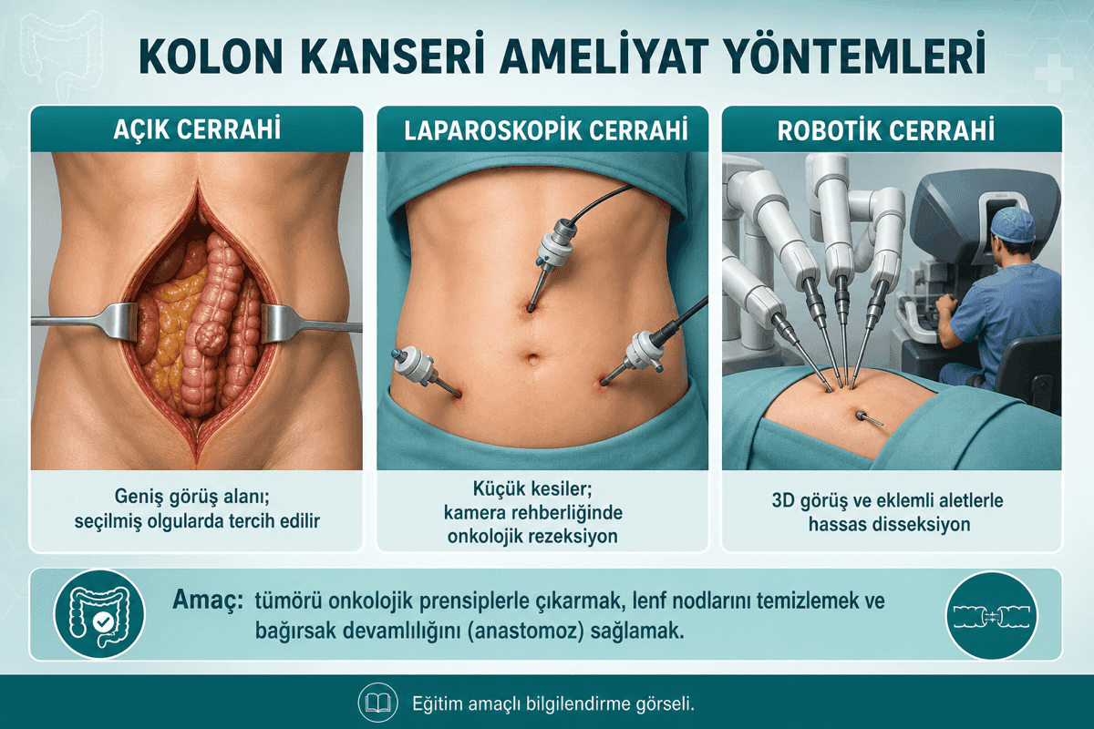 Açık, laparoskopik ve robotik kolon cerrahisi Türkçe eğitim görseli