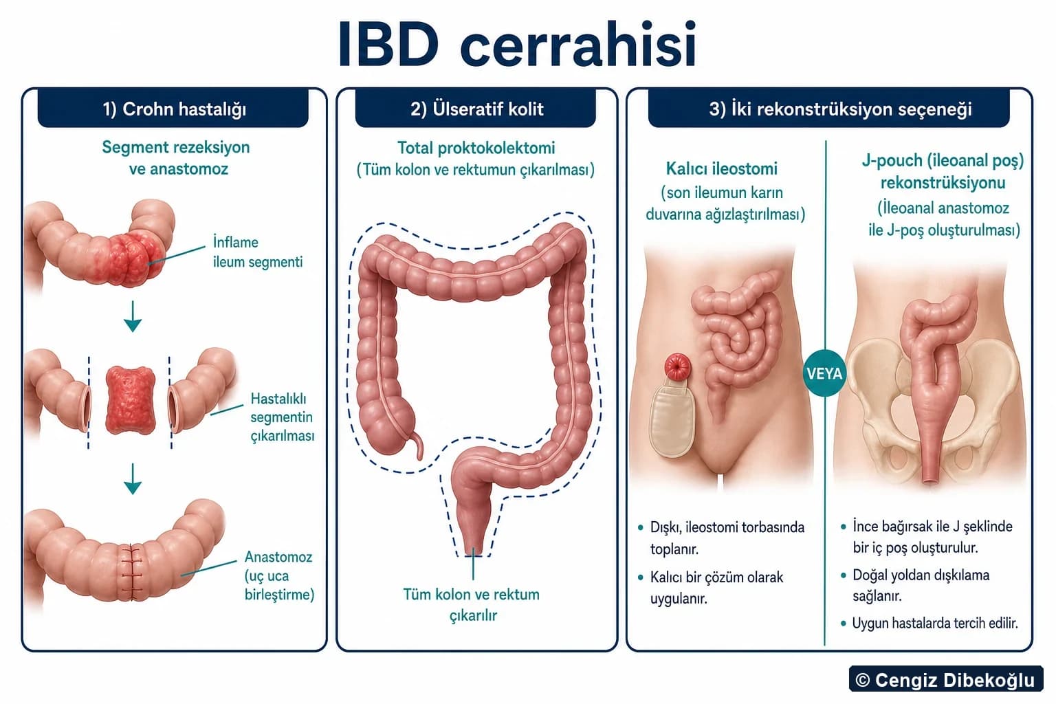 Cerrahi seçenekler