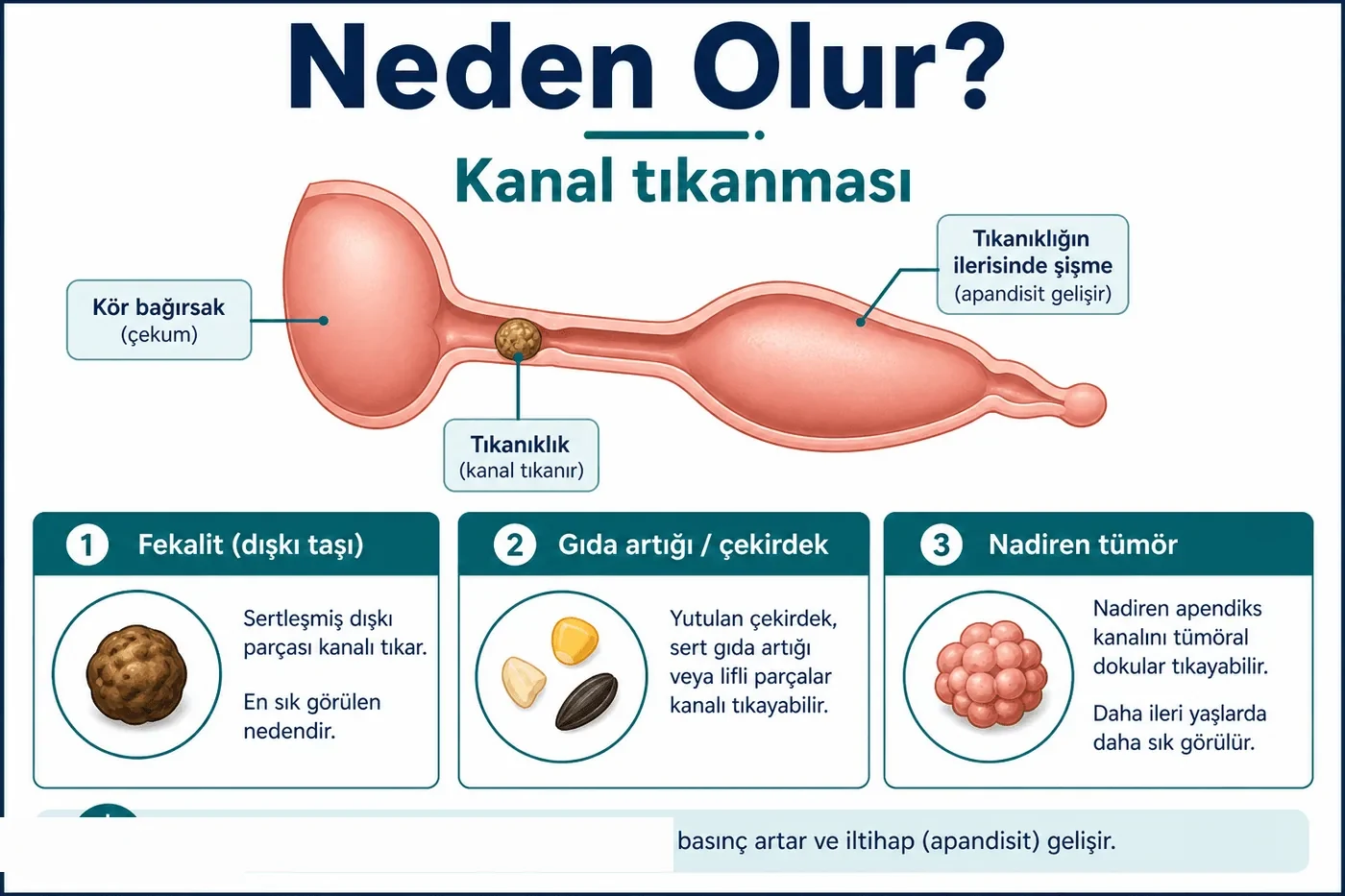 Neden olur?