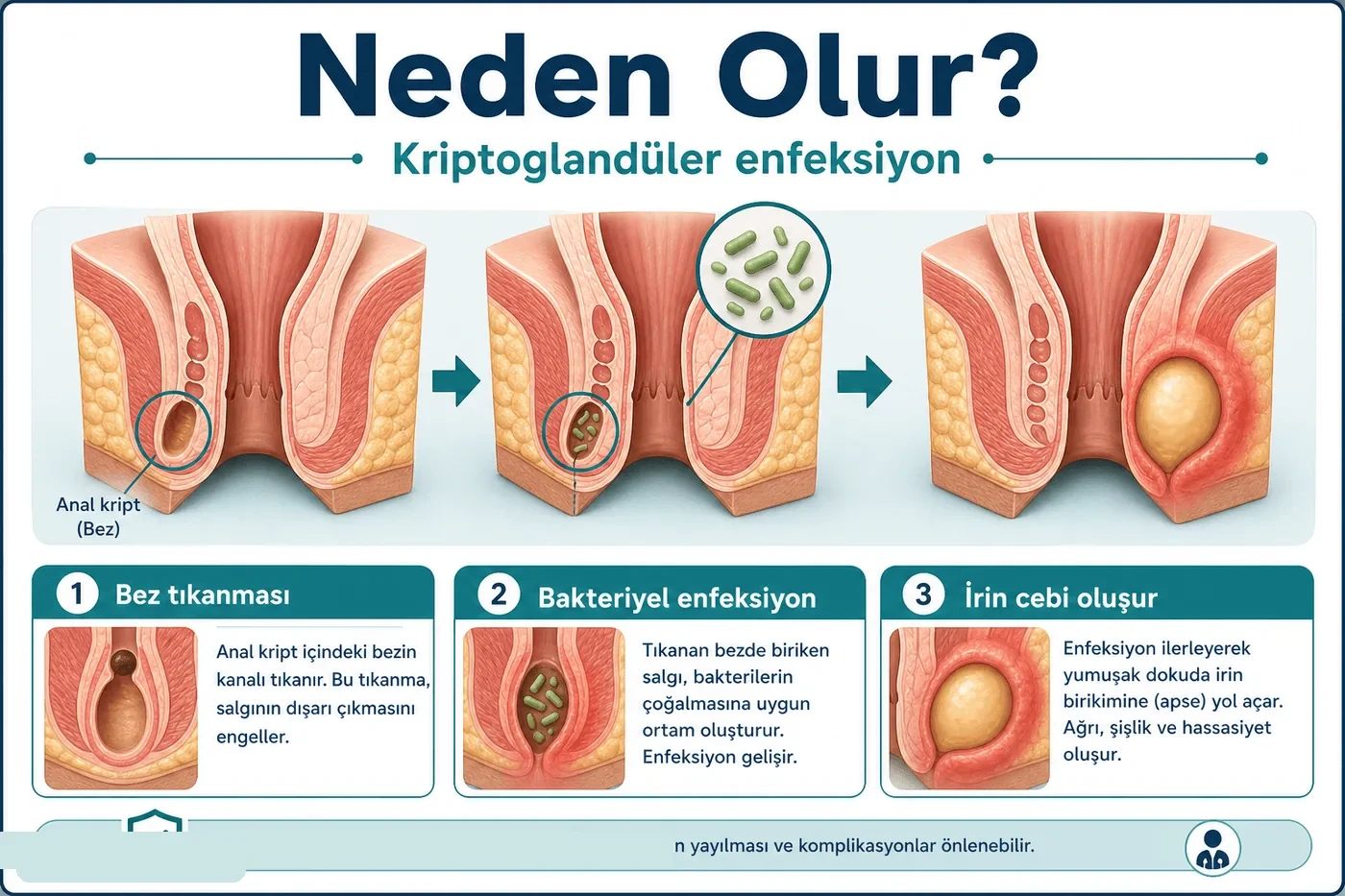 Neden olur?