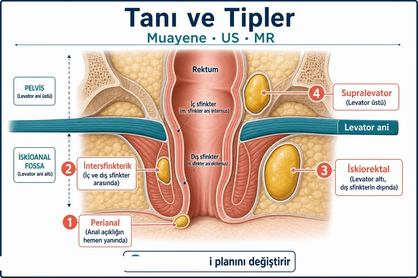 Tanı ve tipler