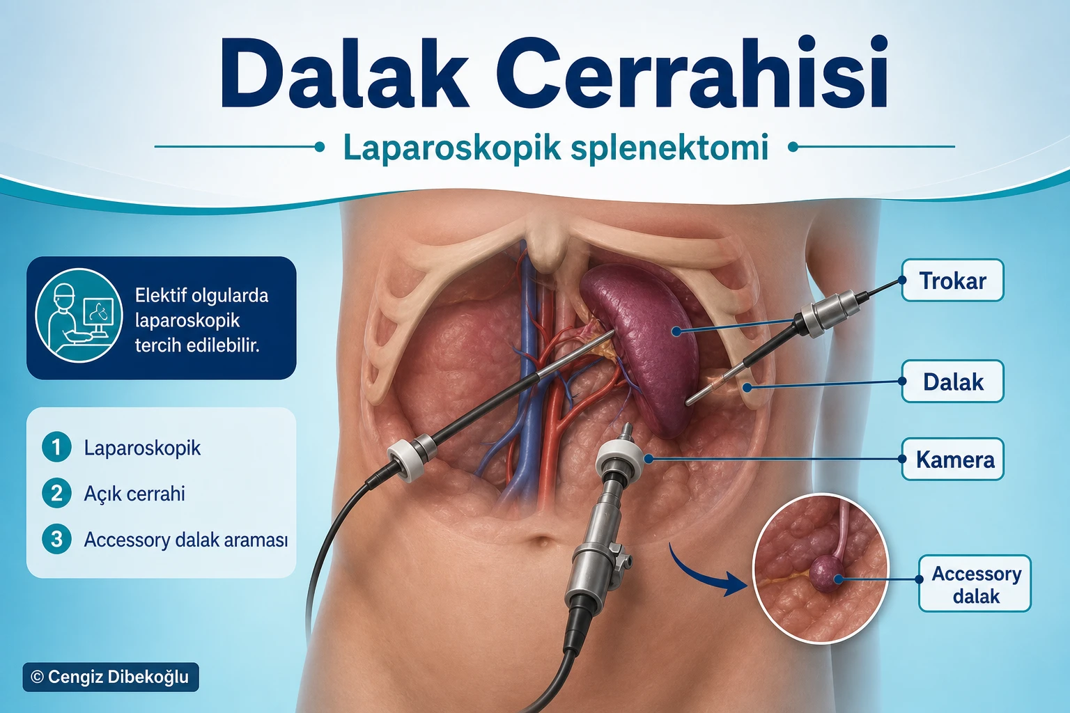 Cerrahi
