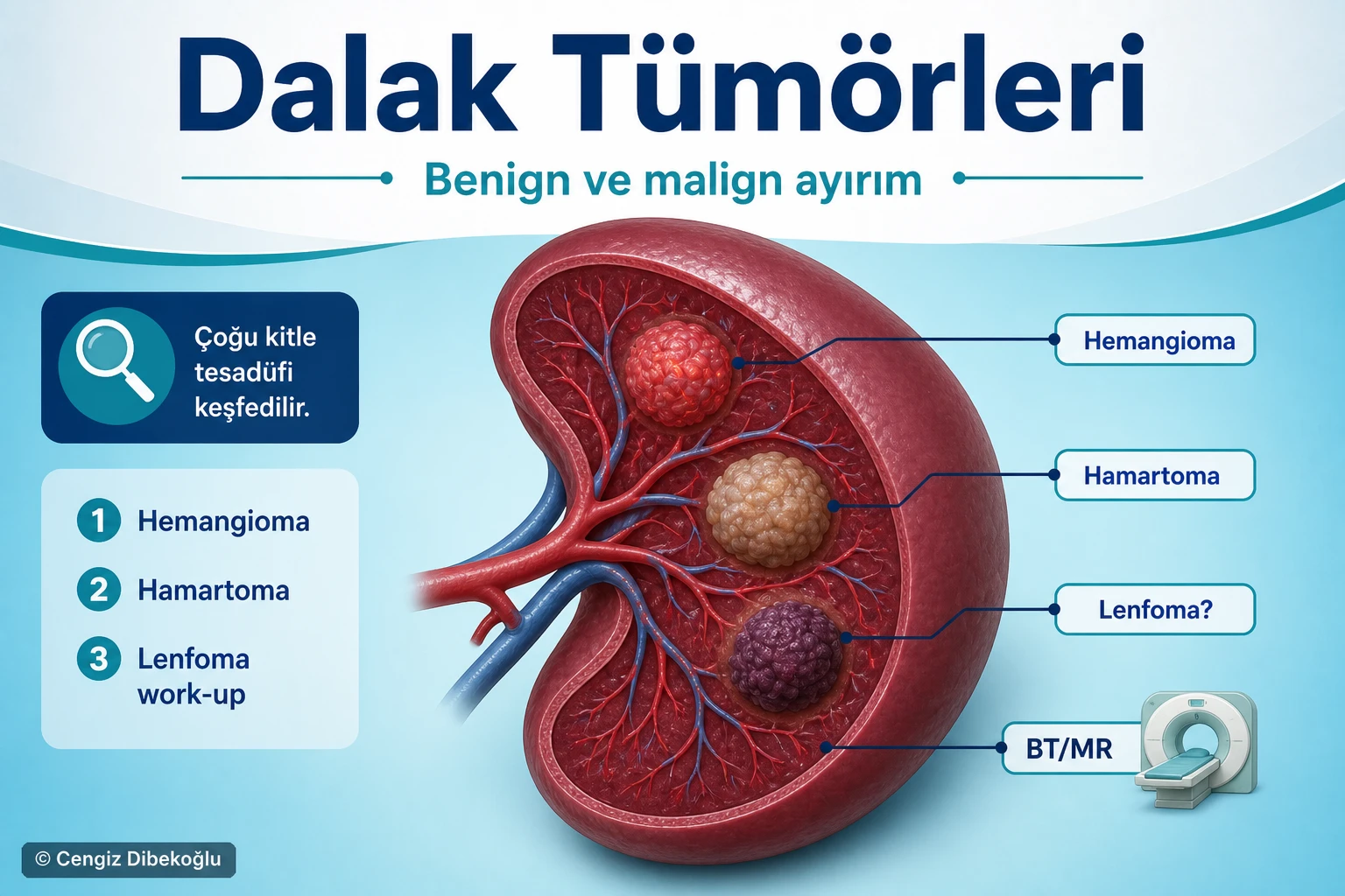 Dalak tümörleri