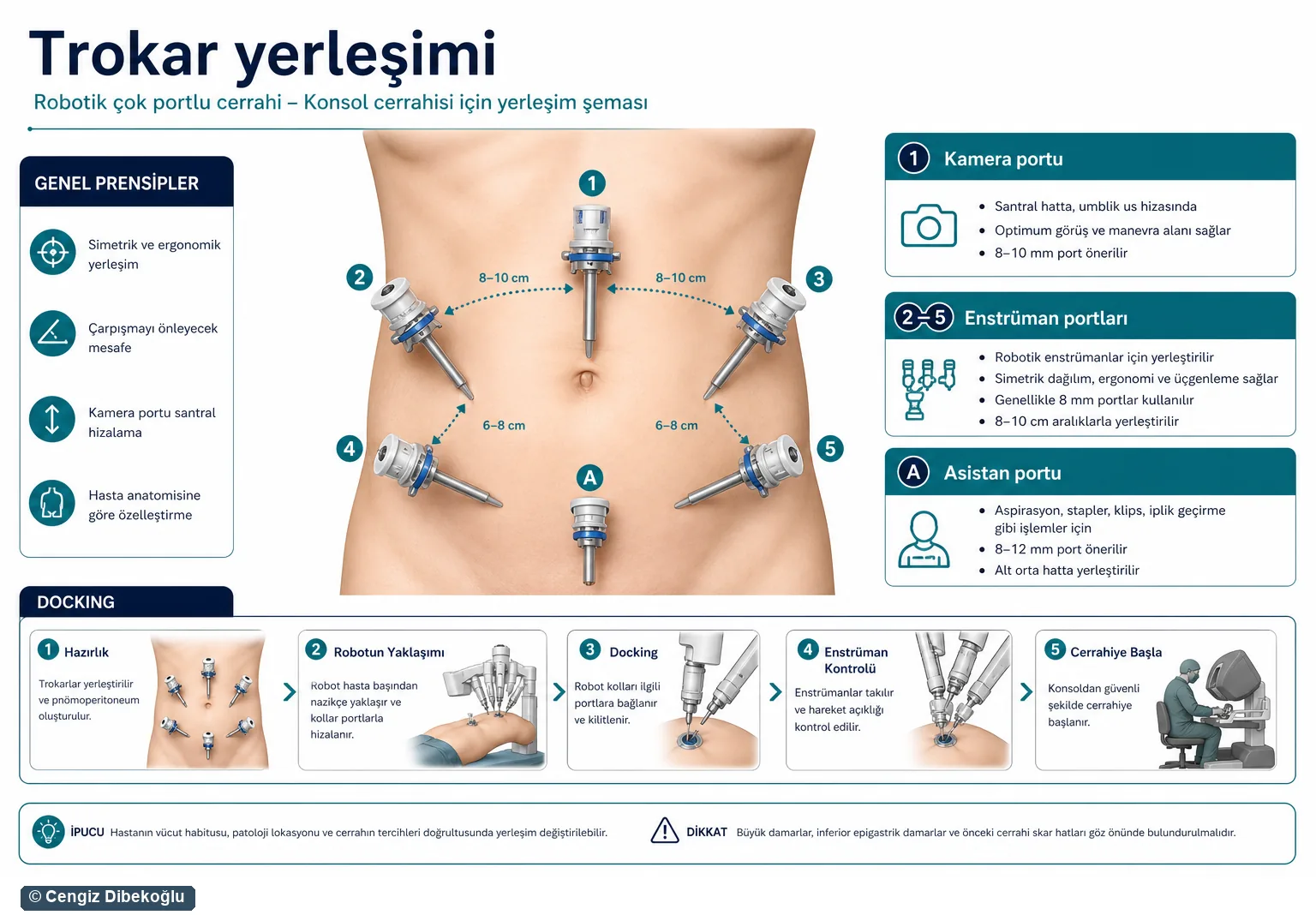 Trokar yerleşimi 3D