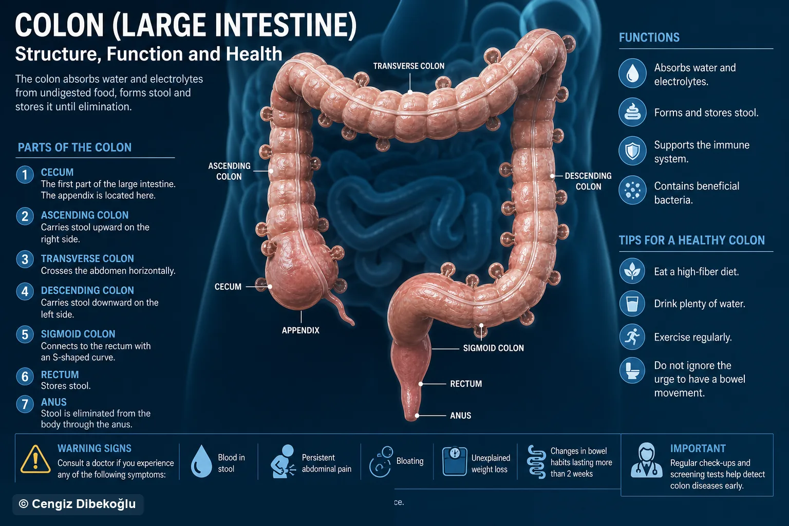 3D diagram: What it is — what diverticular disease is