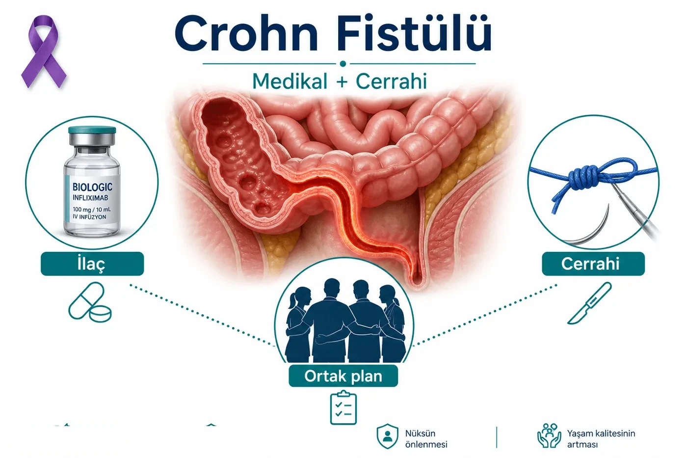 Crohn