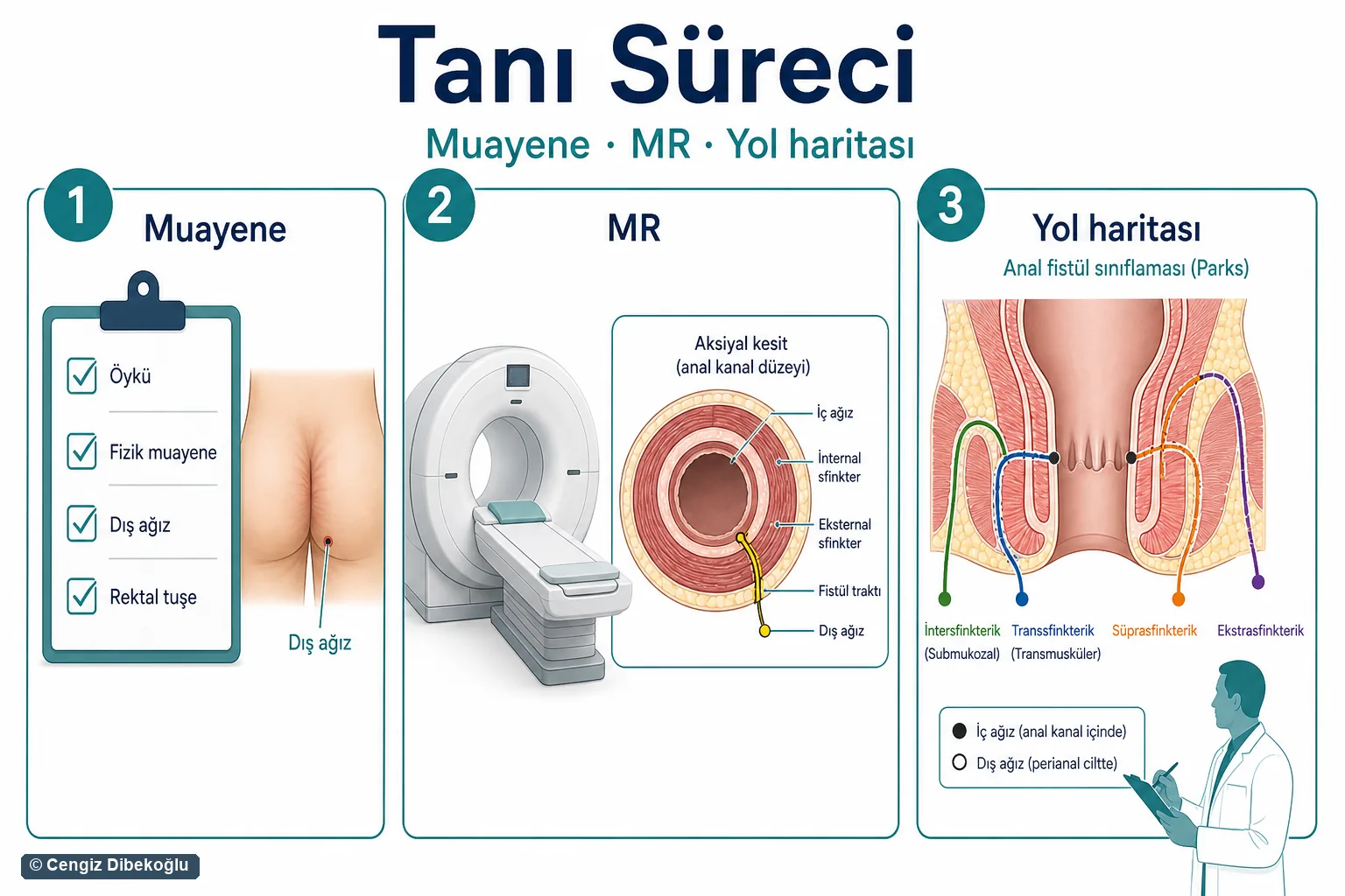 Tanı