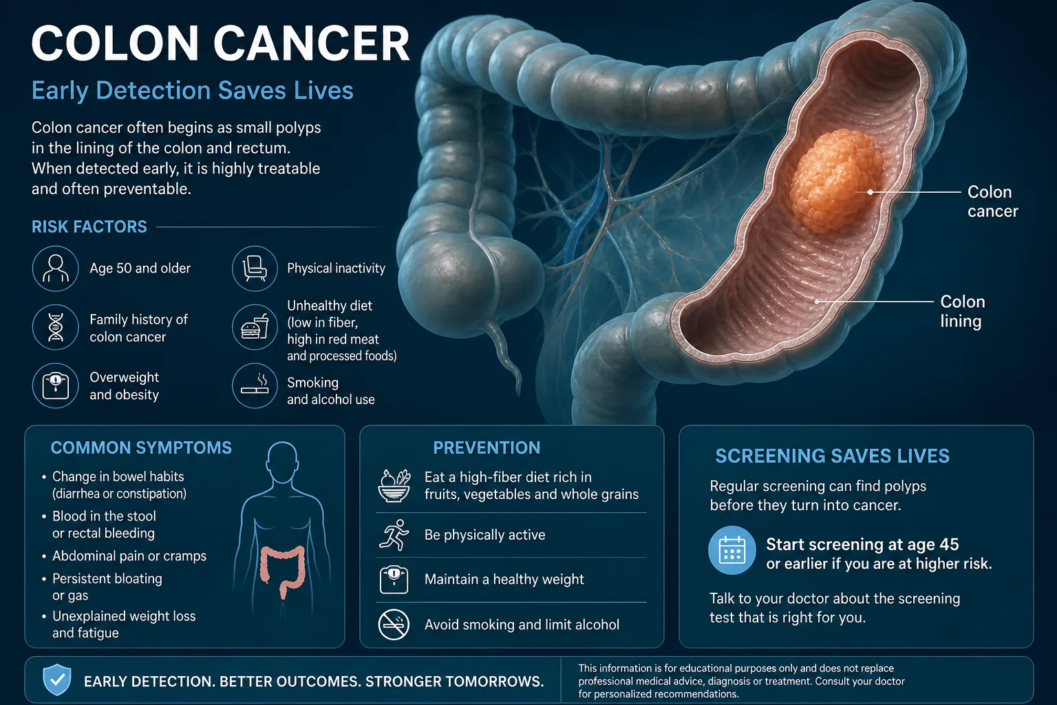 3D diagram: Tumor pattern — colon tumor