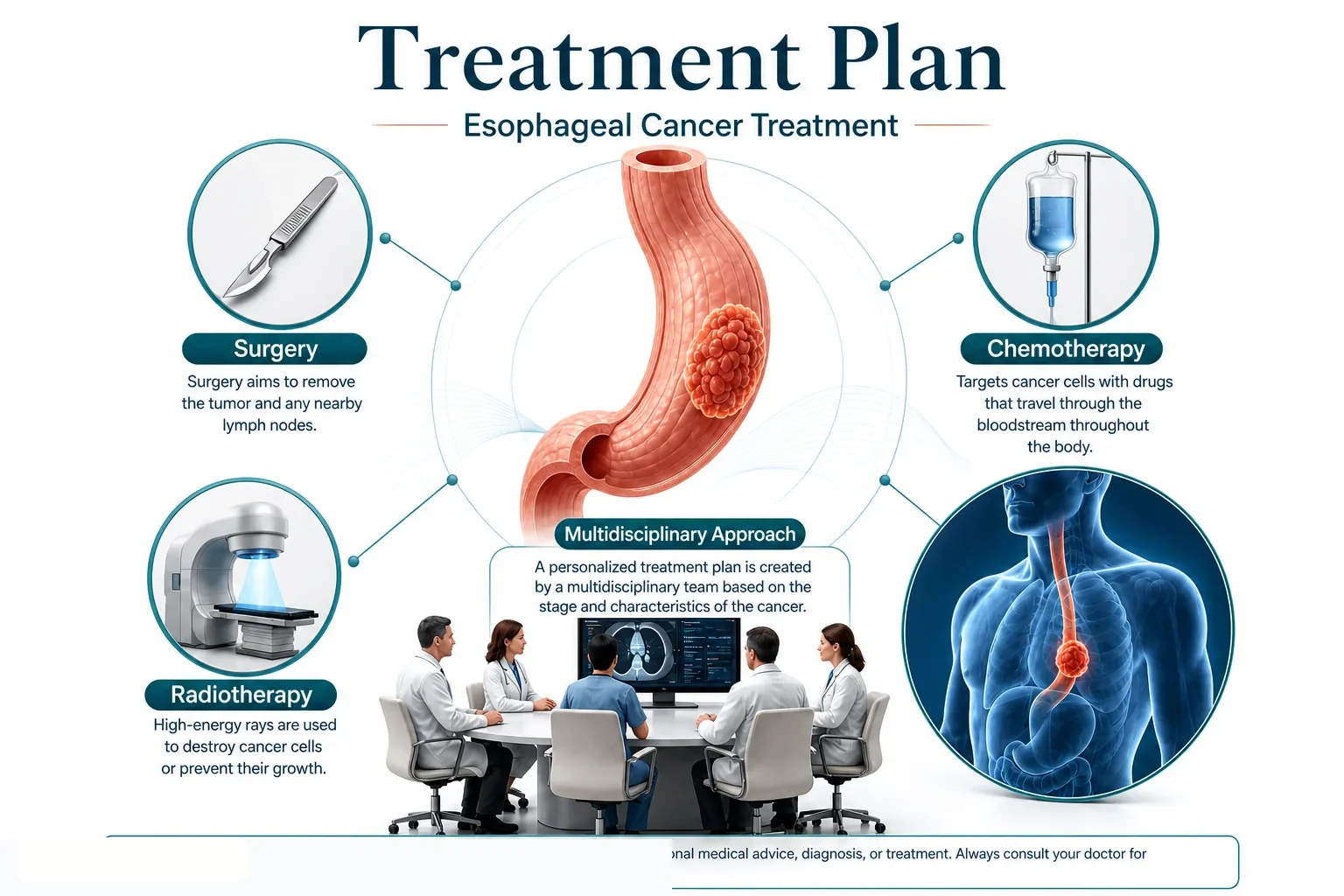 3D diagram: Treatment — esophageal cancer treatment