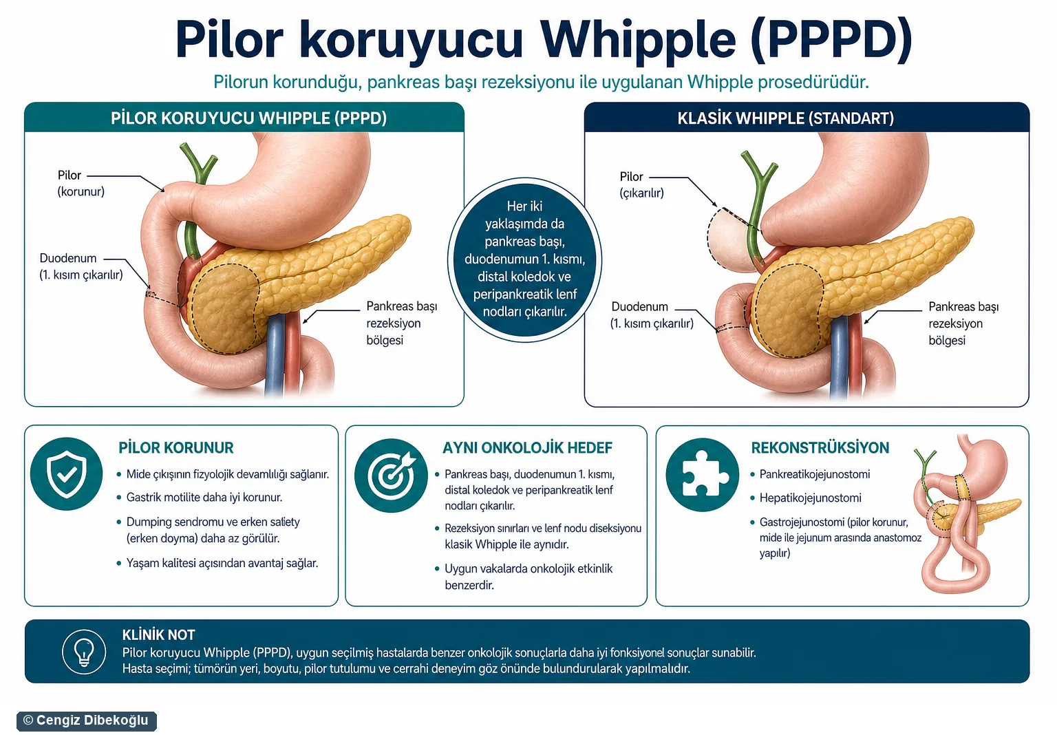 Pilor koruyucu Whipple 3D