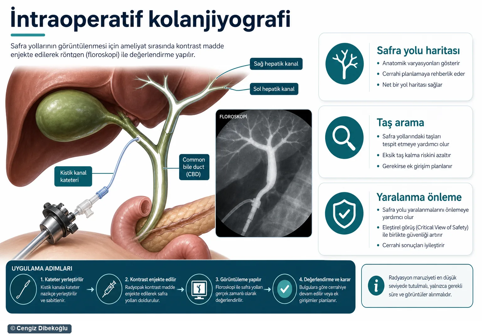 İntraoperatif kolanjiyografi 3D