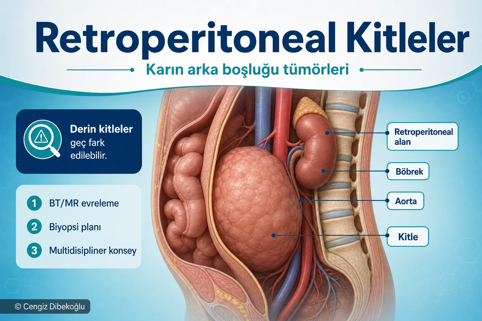 Retroperitoneal