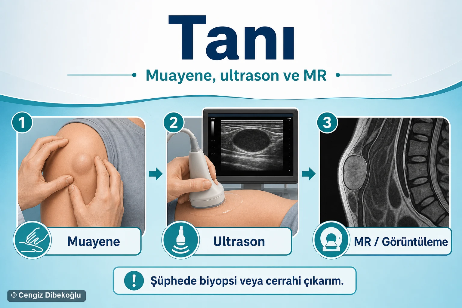 Genel tanı