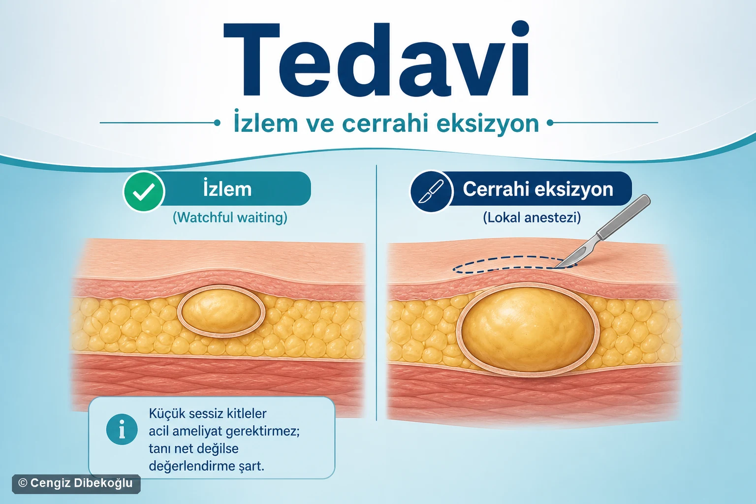 Genel tedavi